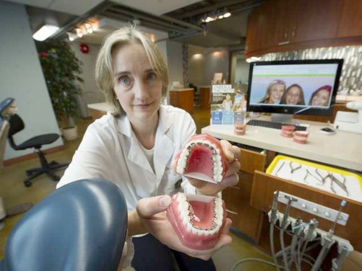 DIY braces trend #39 scary #39 for B C orthodontists Victoria Times Colonist
