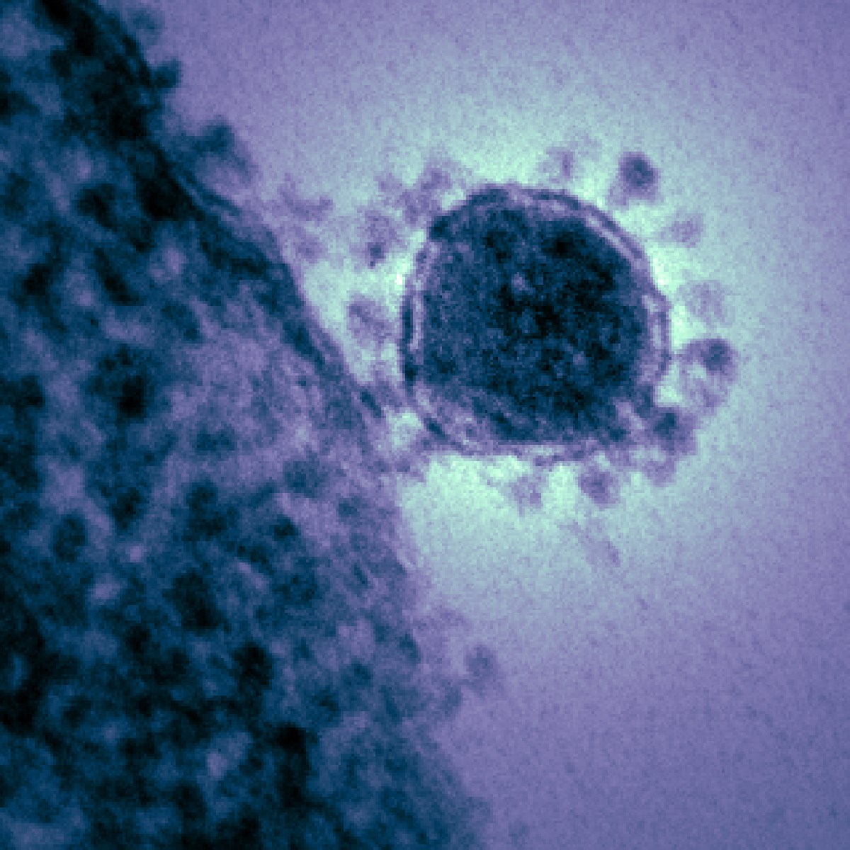 first-b-c-resident-with-novel-coronavirus-has-recovered-kamloops-this-week