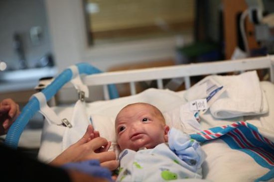 Eli Thompson is treated at the NICU at USA Children's and Women's Hospital in Mobile, Ala., on March 19, 2015. Eli was born at South Baldwin Hospital on March 4 without a nose. Besides not having an external nose, he doesn't have a nasal cavity or olfactory system. Eli has an extremely rare condition known as complete congenital arhinia, said his mother Brandi McGlathery, adding that there are only about 37 cases worldwide like his. The chance of being born with congenital arhinia is one in 197 million, she said.