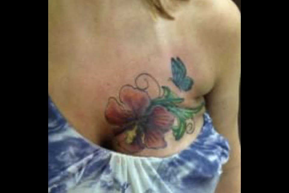 Facebook Removes Photo Of Breast Cancer Survivor's Tattoo, Users