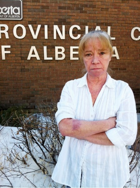 Olds resident Lynn McKay stands in front of the Didsbury provincial court on Friday following the first day of a dangerous dog hearing. She looks at the scar on her right