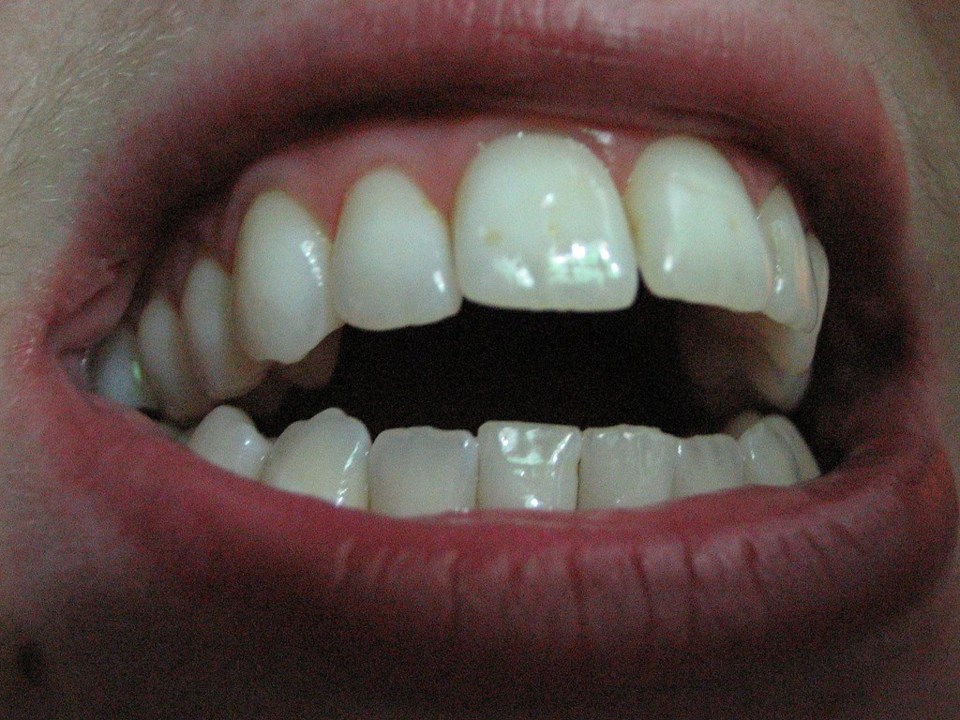 Teeth