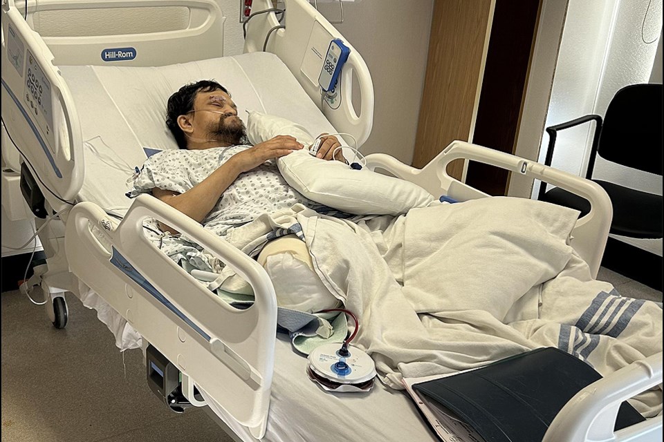 Vincent Martin Spyglass is in a Saskatoon hospital after being struck by a car while he was walking on a North Battleford street. He has lost his leg.