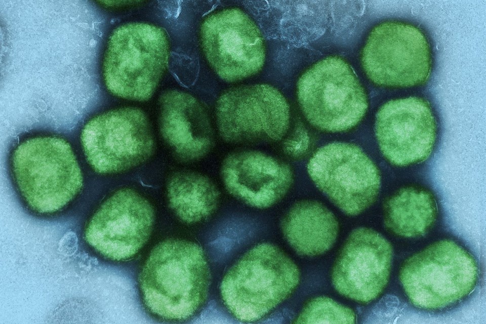 Colorized transmission electron micrograph of monkeypox virus particles (green) cultivated and purified from cell culture. Image captured at the NIAID Integrated Research Facility (IRF) in Fort Detrick, Maryland.