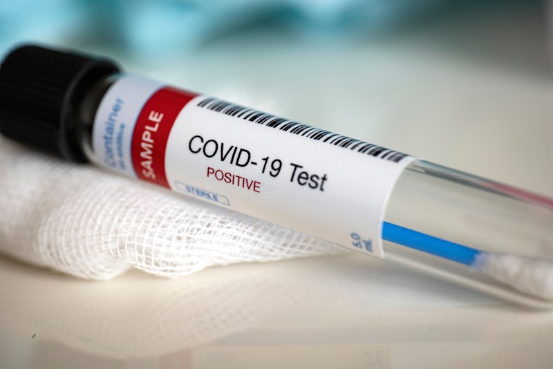 Ontario's COVID test processing dips on Tuesdays, here's why - Timmins News