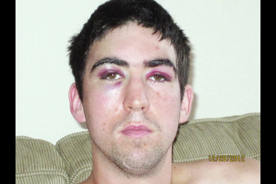 Kyle Mockford shortly after suffering a traumatic brain injury in 2012. Via Kyle Mockford 